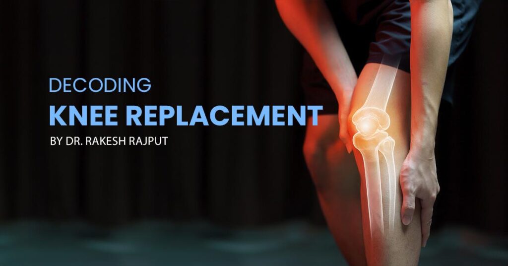 Decoding Knee Replacement